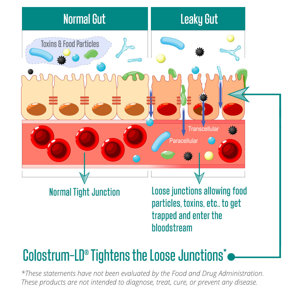 https://www.sovereignlaboratories.com/mm5/graphics/00000001/1/Leaky-Gut-Graphic-1000x1000.jpg